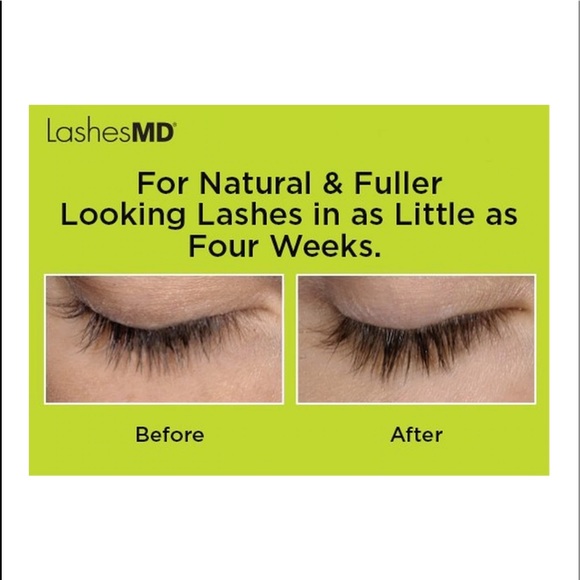 Lashes MD Conditioner NIB - Picture 4 of 5